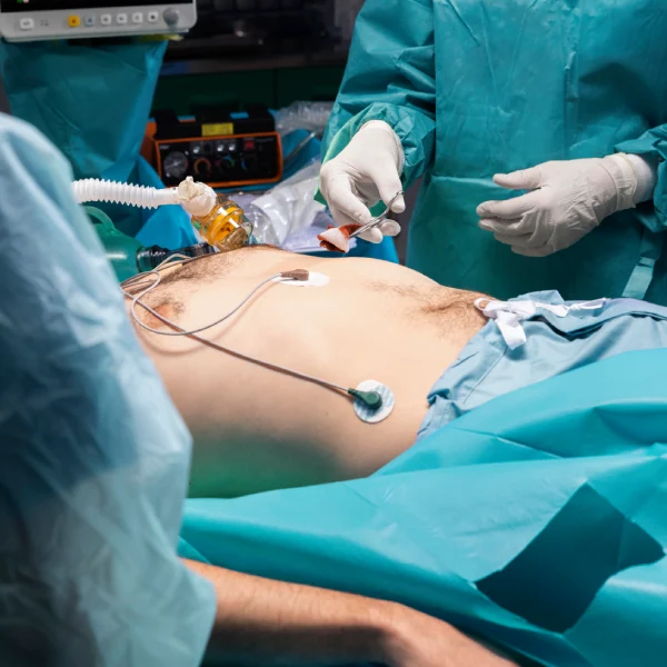 Appendicitis Treatment