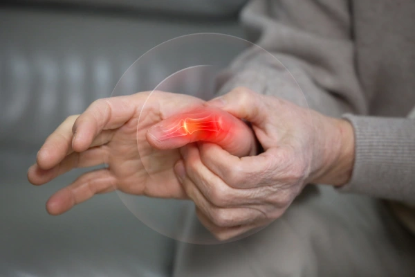 Arthritis