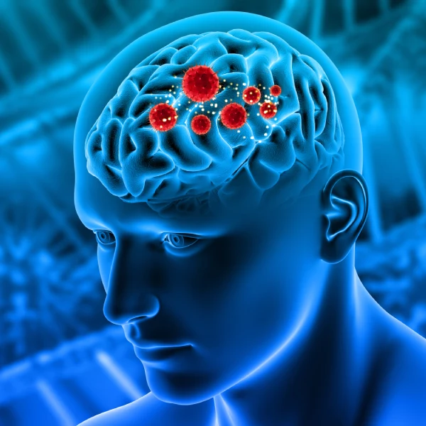 Brain Tumours