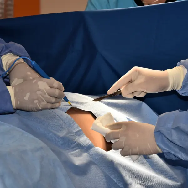 Kidney Biopsy