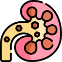 Kidney Stones