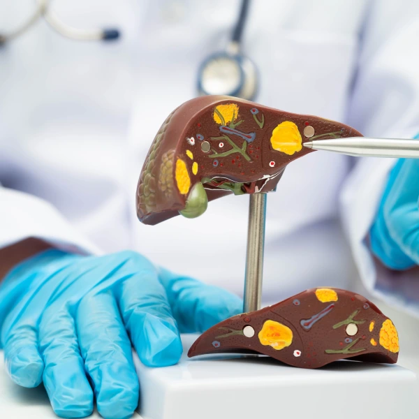 Liver Biopsy