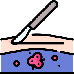 Oncology Surgery